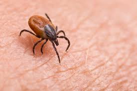 Close-up of a tick crawling on human skin.