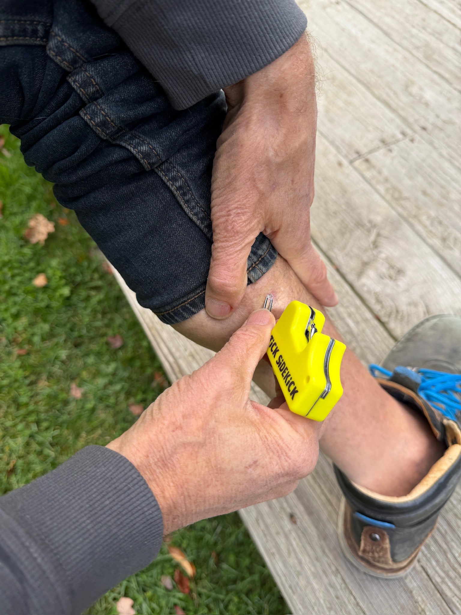 Person using tick remvoal tool on their leg