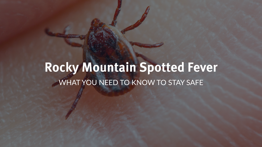 Rocky Mountain Spotted Fever: What You Need to Know to Stay Safe Outdoors This Summer